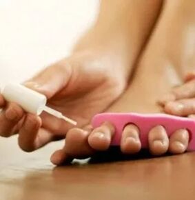 Application of the therapeutic varnish